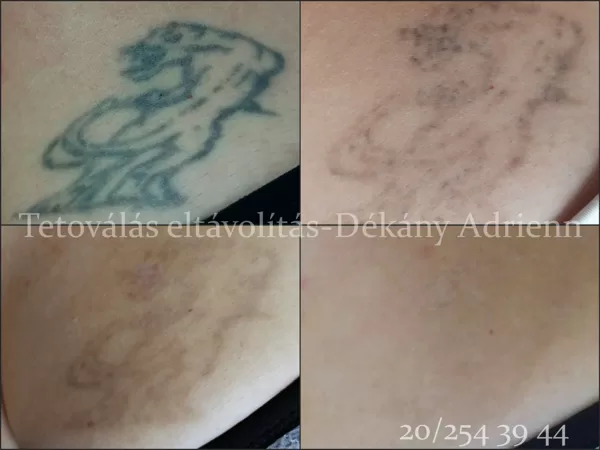 Egy befejezett munka: teljes eltávolítás.