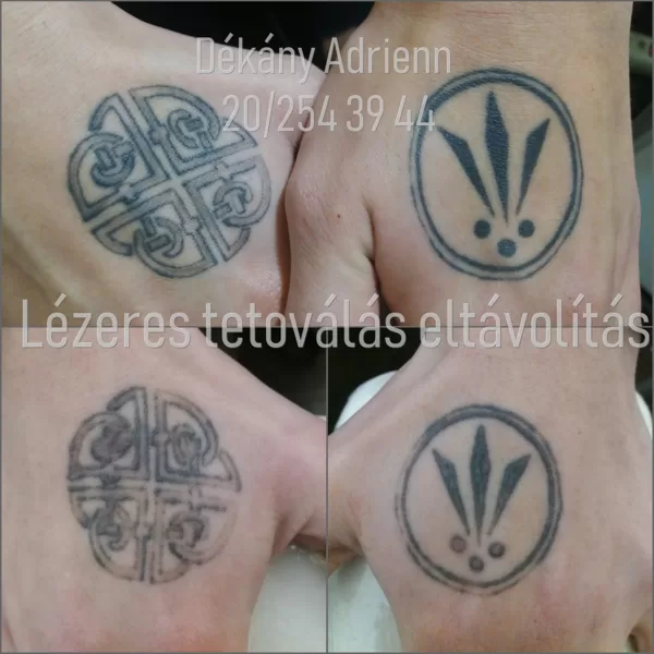 Egy kezelés eredménye... folyamatban