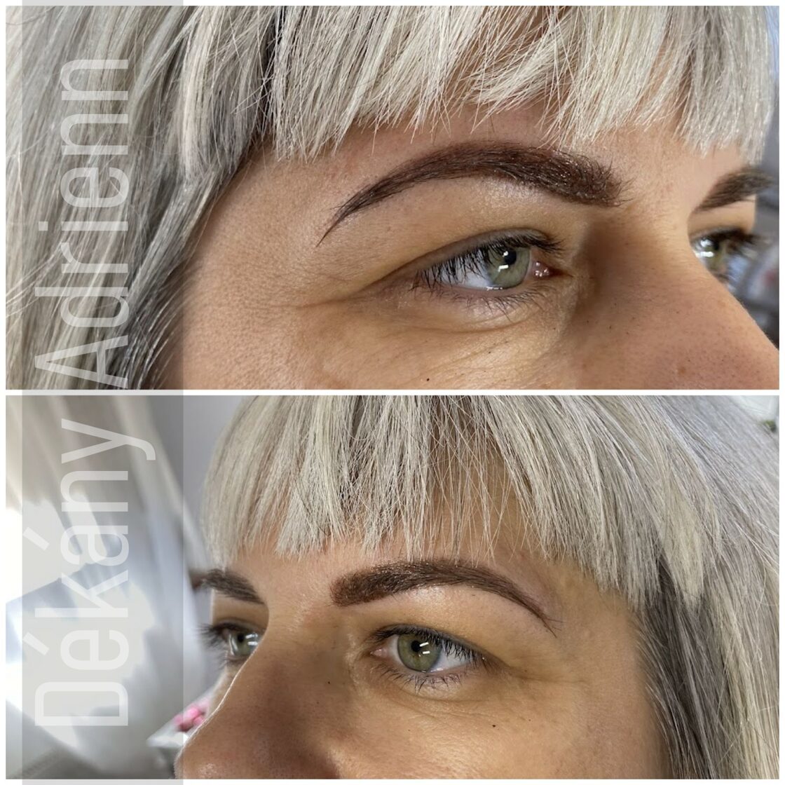 Kecskemét Dékány Adrienn sminktetoválás lézer hegkezelés