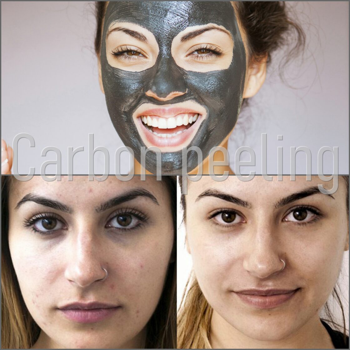 Kecskemét Dékány Adrienn hegkezelés