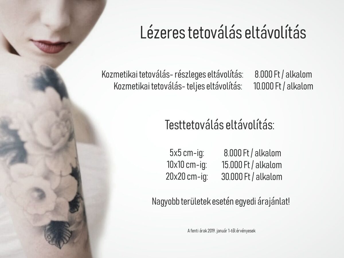 Kecskemét Dékány Adrienn lézer árlista